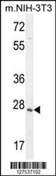 ZCCHC17 Antibody