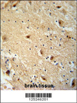 TBC14 Antibody
