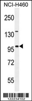 ITIH5 Antibody