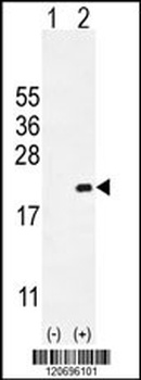 CDKN2C Antibody