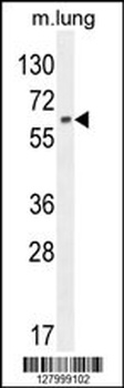 NFE2L1 Antibody