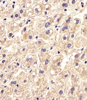 SLC16A11 Antibody