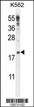 IQCJ Antibody