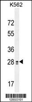 TEX13B Antibody