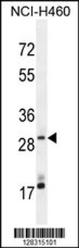 MAGIX Antibody