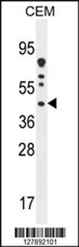 DNAJC22 Antibody