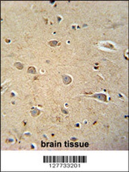 PQLC1 Antibody
