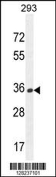 OR10H1 Antibody