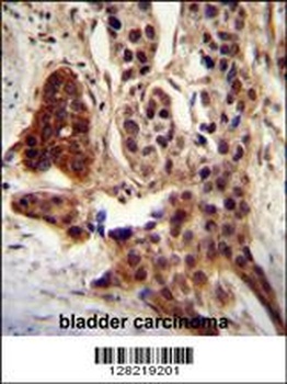 CCDC122 Antibody