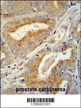 BCORL1 Antibody