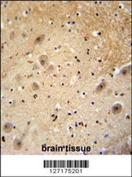 WDSOF1 Antibody