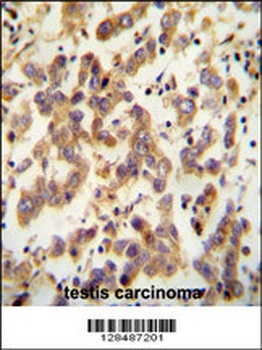 C20orf173 Antibody