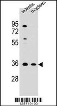 ASB17 Antibody