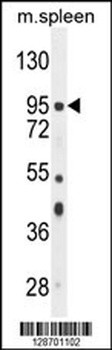 NSUN2 Antibody