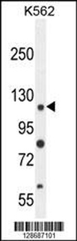 ANKRD52 Antibody