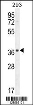 SACA1 Antibody