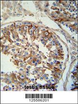 SACA1 Antibody