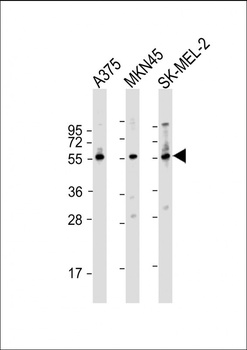 GSDMC Antibody