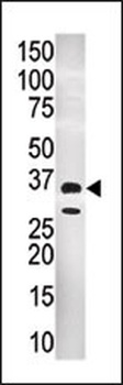 GNMT Antibody