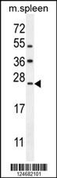 LMO4 Antibody