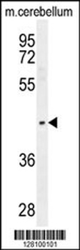 PTOV1 Antibody
