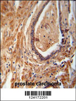 NDUFAF1 Antibody