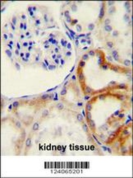 HYAL2 Antibody