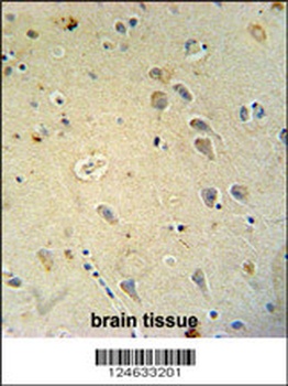 GRIA4 Antibody