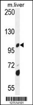 DHTKD1 Antibody