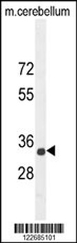 CADM1 Antibody