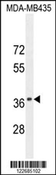 CADM1 Antibody