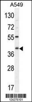 C5AR1 Antibody