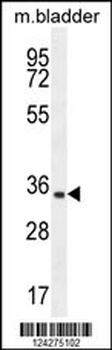 C15orf41 Antibody