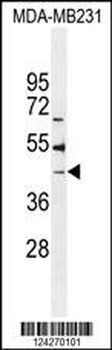 B4GALT6 Antibody