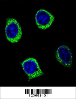 AMY2B Antibody