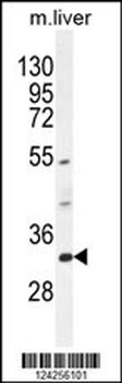 FAM78B Antibody