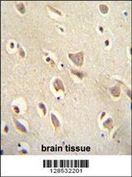 MCHR1 Antibody