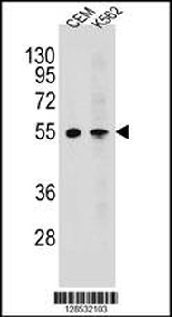 MCHR1 Antibody