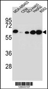 HP Antibody