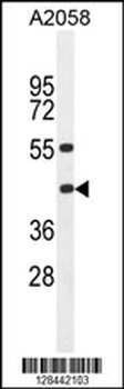 HLA-B Antibody