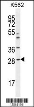 APCS Antibody