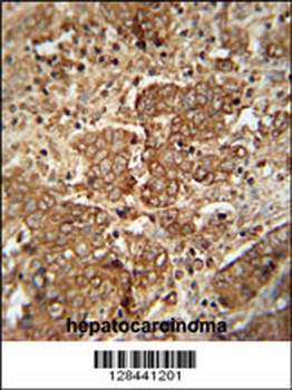APCS Antibody