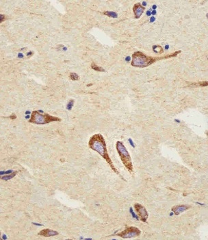 CB2 Antibody