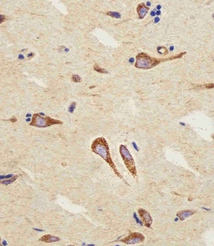 CNR2 Antibody