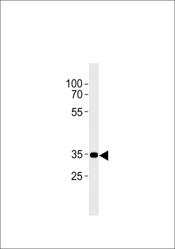 CNR2 Antibody