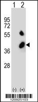 BCKDHB Antibody