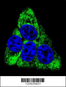 BCKDHB Antibody