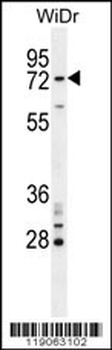 BARD1 Antibody