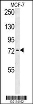 ARHGAP44 Antibody