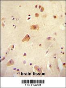 ARHGAP44 Antibody